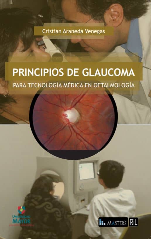 Principios de glaucoma para tecnología médica en oftalmología 1
